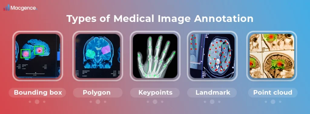 Types of Medical Image Annotation
